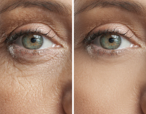 10 Wrinkle-Fighting Hacks You’ll Wish You Knew Sooner